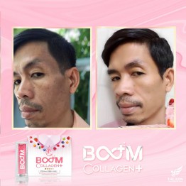 Review - รีวิว Boom Collagen Plus