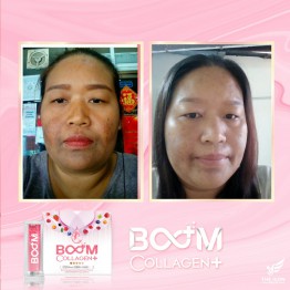 Review - รีวิว Boom Collagen Plus