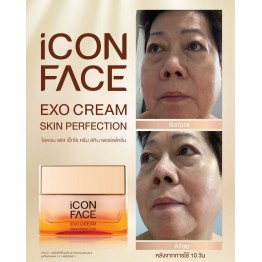 Review - รีวิว iCon Face Exo Cream
