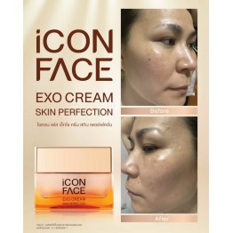 Review - รีวิว iCon Face Exo Cream