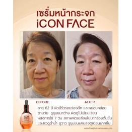 Review - รีวิว iCon Face iSerum