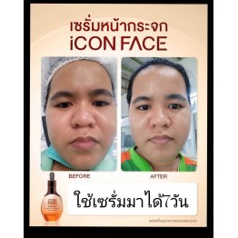 Review - รีวิว iCon Face iSerum